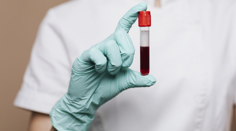 Exame de Sangue